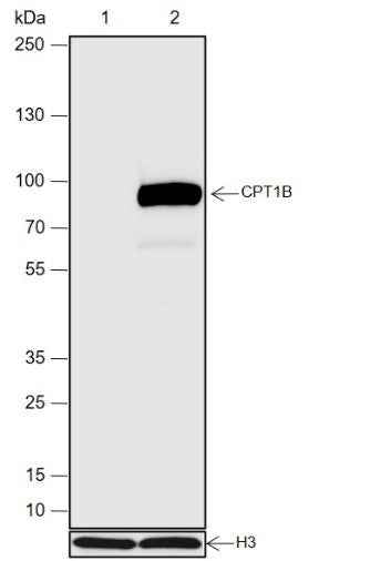 Anti-Human CPT1B Antibody [A672]