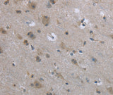 Anti-Human/Mouse/Rat EGFL8 Antibody - ABMIUM