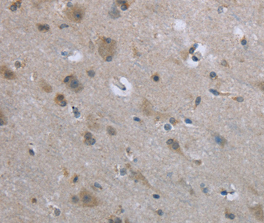 Anti-Human/Mouse/Rat EGFL8 Antibody - ABMIUM