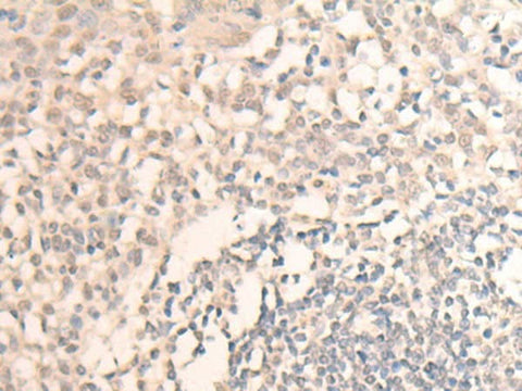 Immunohistochemistry of paraffin-embedded Human tonsil tissue using MLLT6 Polyclonal Antibody at dilution of 1:40(×200)
