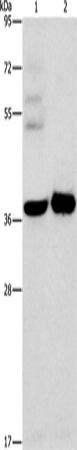 Anti-Human/Mouse/Rat SERPINE2 Antibody - ABMIUM