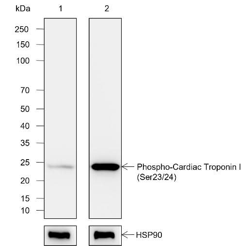 Anti-Human Phospho-Cardiac Troponin I (Ser23, Ser24) Antibody [A828] - ABMIUM