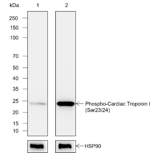 Anti-Human Phospho-Cardiac Troponin I (Ser23, Ser24) Antibody [A828] - ABMIUM