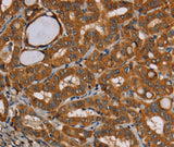 Anti-Human CENPU Antibody - ABMIUM