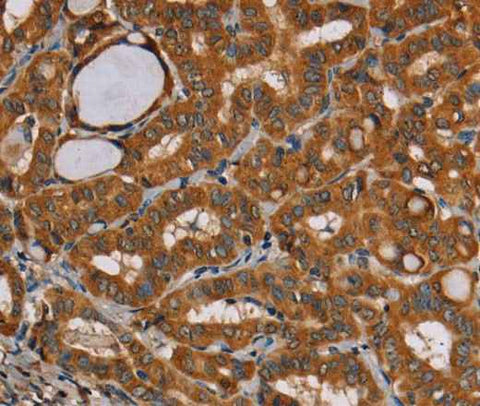 Anti-Human CENPU Antibody