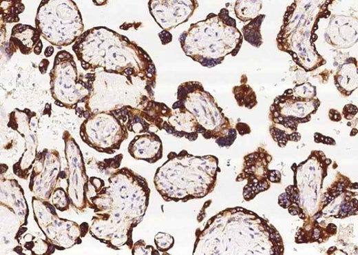 Anti-Human TNFAIP8 Antibody [A916] - ABMIUM