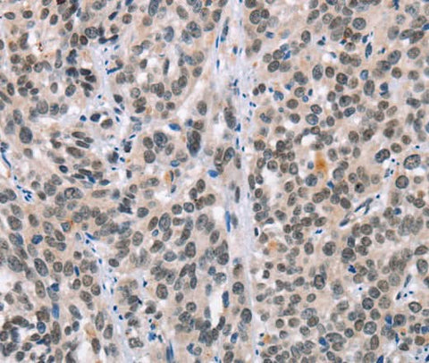 Anti-Human/Mouse/Rat ADNP Antibody - ABMIUM