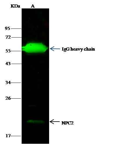 Anti-Human NPC2 Antibody [A1164] - ABMIUM