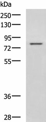 Western blot analysis of Rat liver tissue lysate using DHX58 Polyclonal Antibody at dilution of 1:800