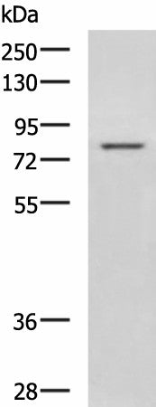Western blot analysis of Rat liver tissue lysate using DHX58 Polyclonal Antibody at dilution of 1:800