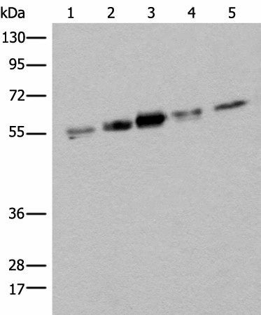 Western blot analysis of Hela HEPG2 231 A431 and Jurkat cell lysates using ZPR1 Polyclonal Antibody at dilution of 1:400