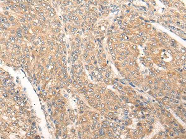 Anti-Human/Mouse/Rat PIAS3 Antibody