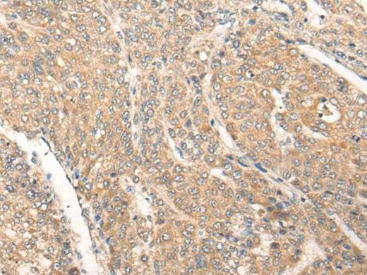 Anti-Human/Mouse/Rat PIAS3 Antibody