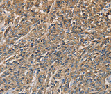 Anti-Human KLK1 Antibody - ABMIUM