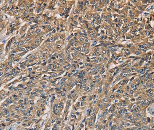 Anti-Human KLK1 Antibody