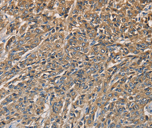 Anti-Human KLK1 Antibody - ABMIUM