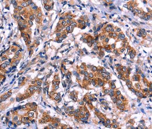 Anti-Human/Mouse EIF2AK4 Antibody