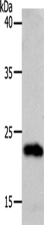 Anti-Human/Mouse/Rat SOCS1 Antibody - ABMIUM
