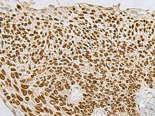 Anti-Human/Mouse/Rat TP63 Antibody