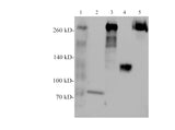 Western blotting with anti-Filamin-c polyclonal antibody at dilution of 1:500. Lane 1: Mouse skeletal muscle lysate, Lane 2: Mouse liver lysate (Negative), lane 3: Rat skeletal muscle lysate, Lane 4:Rat liver lysate (Negative),  Lane 5: Hela cell lysate.