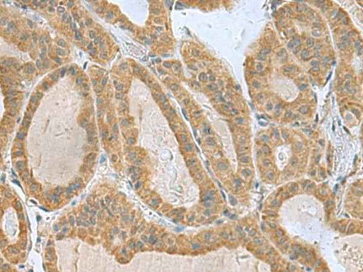 Anti-Human/Mouse SLC30A6 Antibody