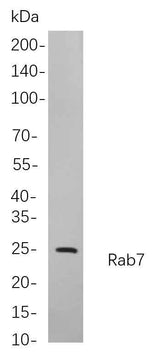 Anti-Human/Mouse/Rat RAB7 Antibody [B732]