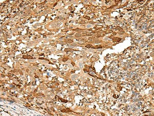 Anti-Human/Mouse PIEZO2 Antibody