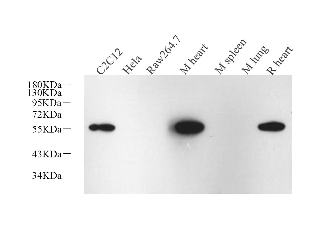 Western Blot analysis of various samples using Desmin Monoclonal Antibody at dilution of 1:1000.