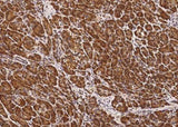 Anti-Human CLPS Antibody [A986] - ABMIUM