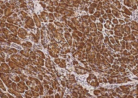 Anti-Human CLPS Antibody [A986] - ABMIUM