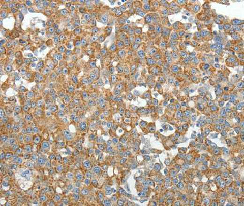 Anti-Human/Mouse/Rat GEMIN2 Antibody