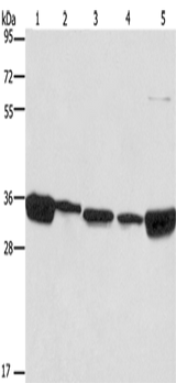 Anti-Human/Mouse ELAVL1 Antibody - ABMIUM