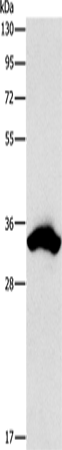 Anti-Human CDCA8 Antibody - ABMIUM