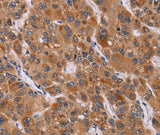 Anti-Human CALCA Antibody - ABMIUM