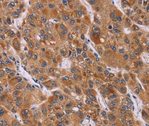 Anti-Human CALCA Antibody