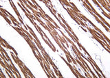 Anti-Human/Mouse/Rat SERCA2 Antibody [B1027]