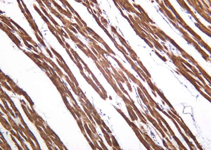 Anti-Human/Mouse/Rat SERCA2 Antibody [B1027] - ABMIUM