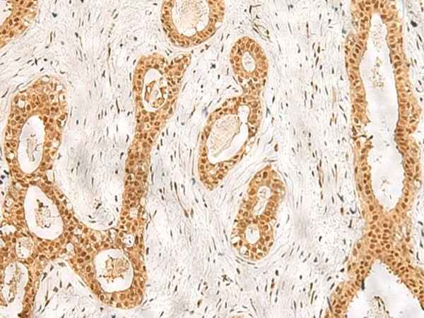 Anti-Human/Mouse/Rat RPS27A Antibody