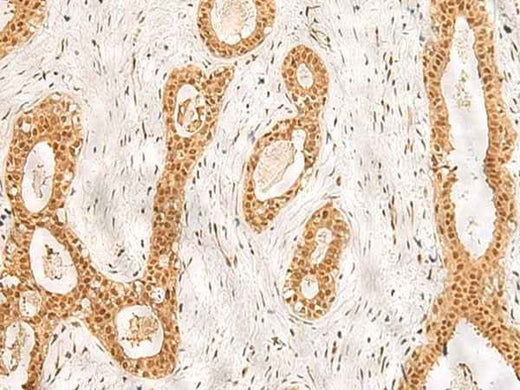 Anti-Human/Mouse/Rat RPS27A Antibody