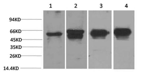 Western Blot analysis of 1) Hela, 2) 293T, 3) Mouse brain, 4) Rat brain using c-Fos Monoclonal Antibody at dilution of 1:2000.