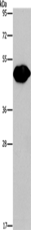 Anti-Human/Mouse PLIN2 Antibody - ABMIUM