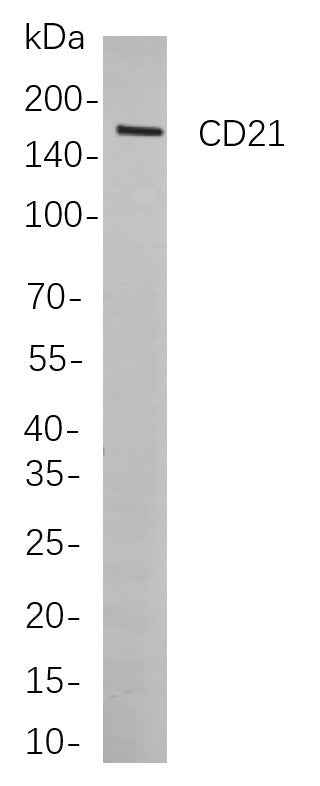 Anti-Human/Mouse/Rat CD21 Antibody [B876] - ABMIUM