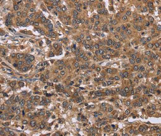 Anti-Human FABP6 Antibody