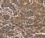 Anti-Human FABP6 Antibody - ABMIUM