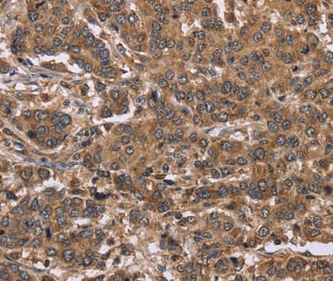 Anti-Human FABP6 Antibody - ABMIUM