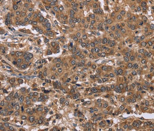 Anti-Human FABP6 Antibody - ABMIUM