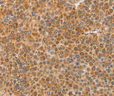 Anti-Human/Mouse/Rat BRS3 Antibody - ABMIUM