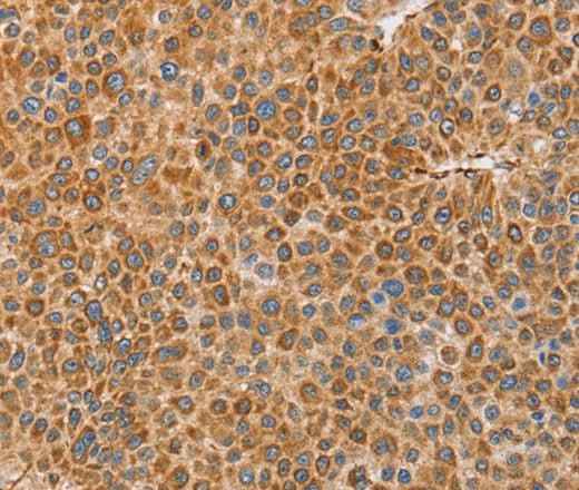 Anti-Human/Mouse/Rat BRS3 Antibody