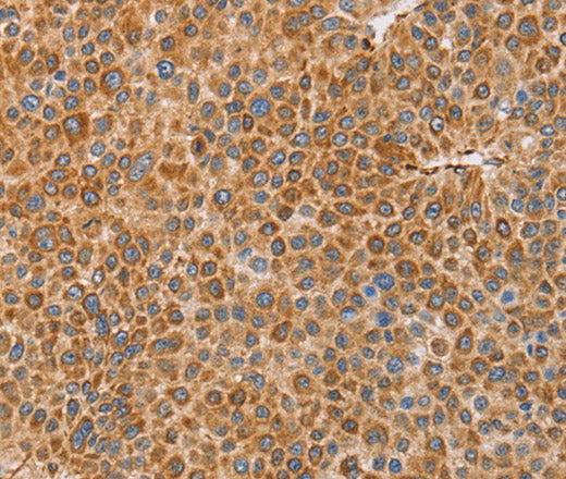 Anti-Human/Mouse/Rat BRS3 Antibody - ABMIUM