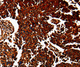 Anti-Human/Mouse ANXA7 Antibody - ABMIUM